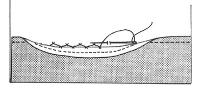 Illustration showing securing the hem with catch stitch.
