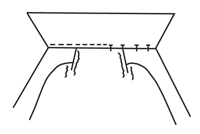 Illustration demonstrating step: Pin upper collar to neckline with folded edge extending slightly over stitching of undercollar. Stitch along folded edge.