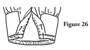 Fig. 26: Serge the band to the sleeve. Secure the threads ends. 