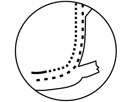 Trim seam allowances of rounded edges close to the gathering stitches.