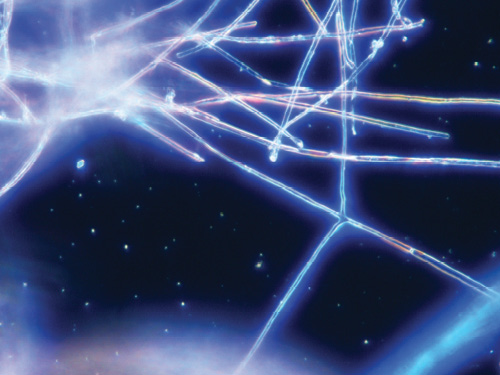 Microscopic view of cruciform hyphae that are unique to Phymatotrichopsis omnivora, showing glowing intersecting lines on a dark background.