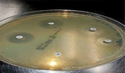 Fig. 01: Photograph of a Petri dish with several cultures of bacteria growing on a growth medium.