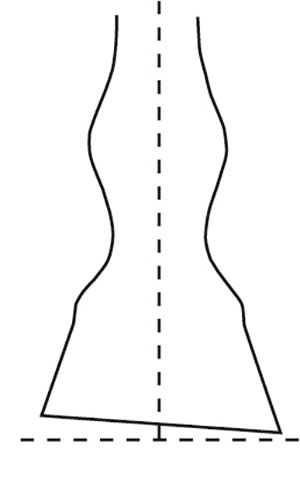Fig. 02: Illustration demonstrating correct and incorrect balance of the hoof wall.