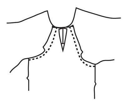 <empty>Sew seams and trim to 3/8 inch (1 cm) from the notches to underarm. Press seams open. 