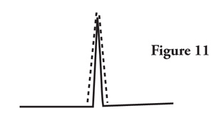 Fig. 11: Reinforce the placket opening by sewing small stitches on the stitching line. Stitch one stitch across point of placket to make turning easier. 