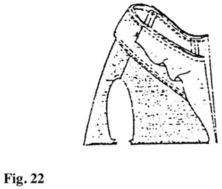 Illustration: Fold partial facing over collar, matching notches and other markings. Sew in place.