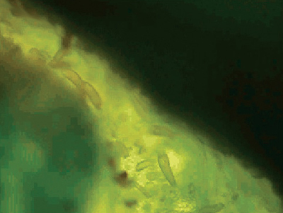 Fig. 03: Photograph of Aceria malherbae gall mites in the mid-vein of a field bindweed leaf (400× magnification).