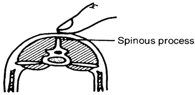 Figure 2. Feel for the spine in the center of the sheep's back behind the last rib and the anterior hipbone.