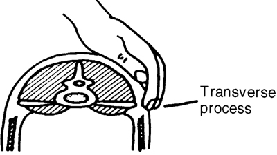 Figure 3. Feel for the tips of the transverse process.
