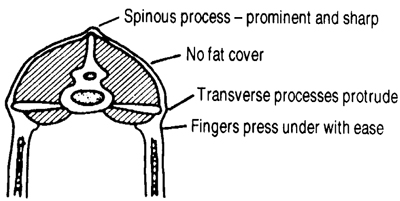 Figure 5. Body Condition One. Sheep is extremely thin, unthrifty, but agile. Skeletal features are prominent with no fat cover. No apparent muscle tissue degeneration. Has strength to remain with the flock.