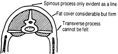 Figure 8. Body Condition Four. Moderate fat deposits give the sheep a smooth external appearance over the shoulder, back, rump, and fore rib. Hip bone is not visible. Firm fat deposit becomes evident in brisket and around tail head.