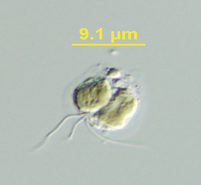 Microscope photograph of a toxic golden algae cell.